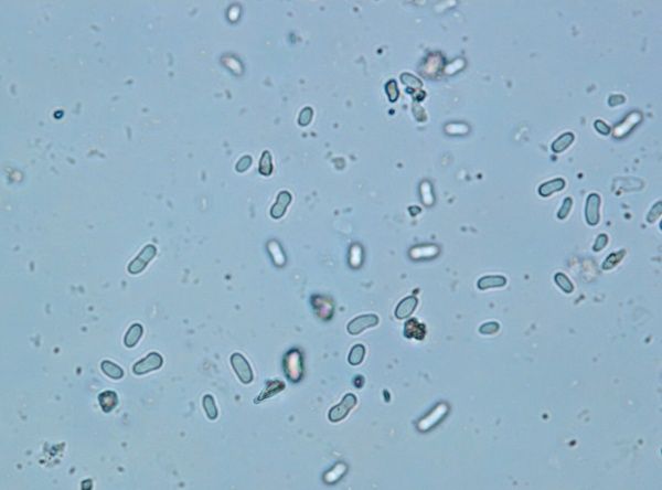 Аскохитоз гороха