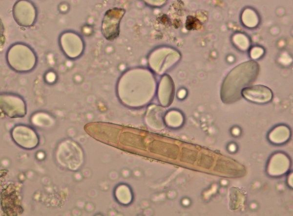 Гельминтоспориозные корневые гнили