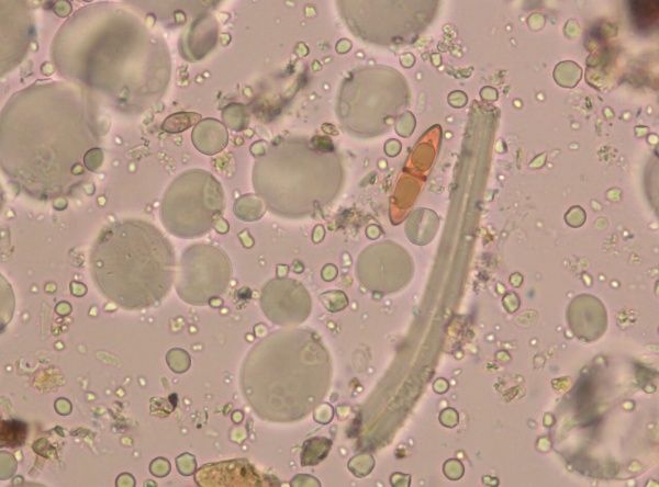 Белая прикорневая гниль (гибеллиноз, белосоломенная гниль, белостебельность)