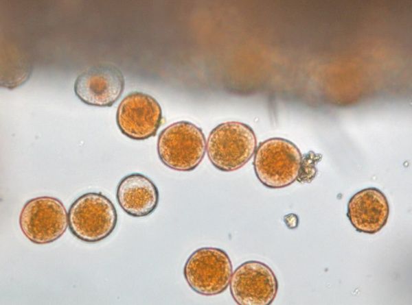 Бурая листовая ржавчина пшеницы