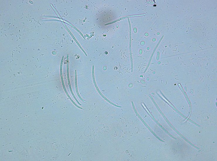 Церкоспороз свеклы