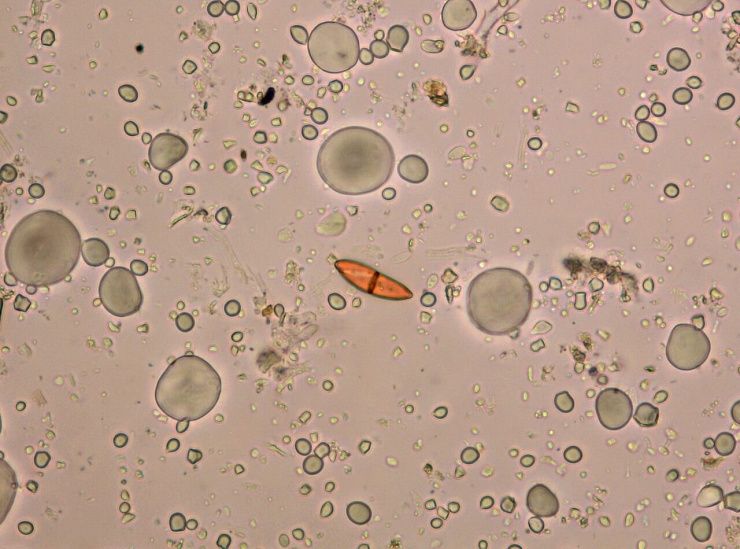 Белая прикорневая гниль (гибеллиноз, белосоломенная гниль, белостебельность)