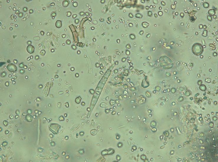 Фузариозные корневые гнили зерновых