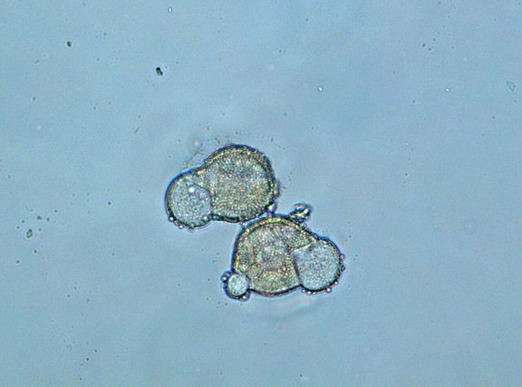 Мучнистая роса зерновых