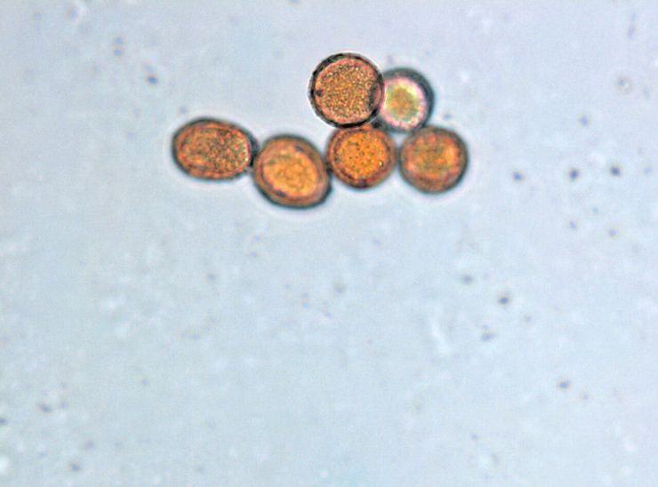 Ржавчина гороха